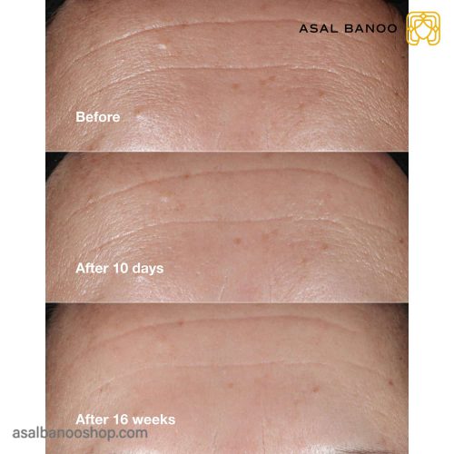 نتایج استفاده از سرم اسمارت کلینیک