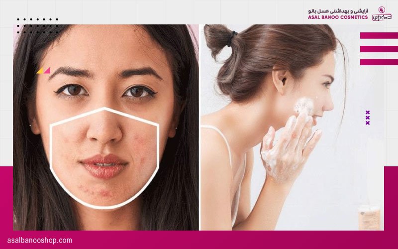 Skin-care-point مراقبت های پوستی در زمان کرونا