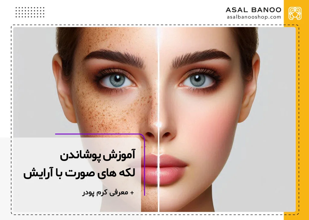 برای پوشاندن لک صورت چکار باید کرد؟