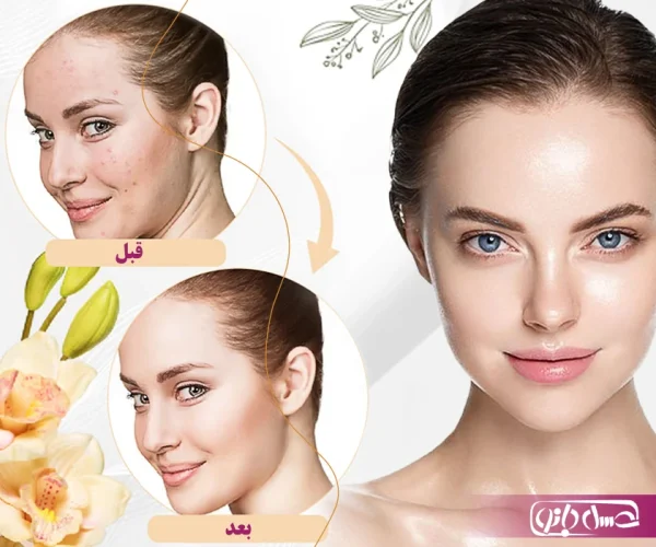 benefits-of-using-toner مزایای استفاده از تونر پوست صورت