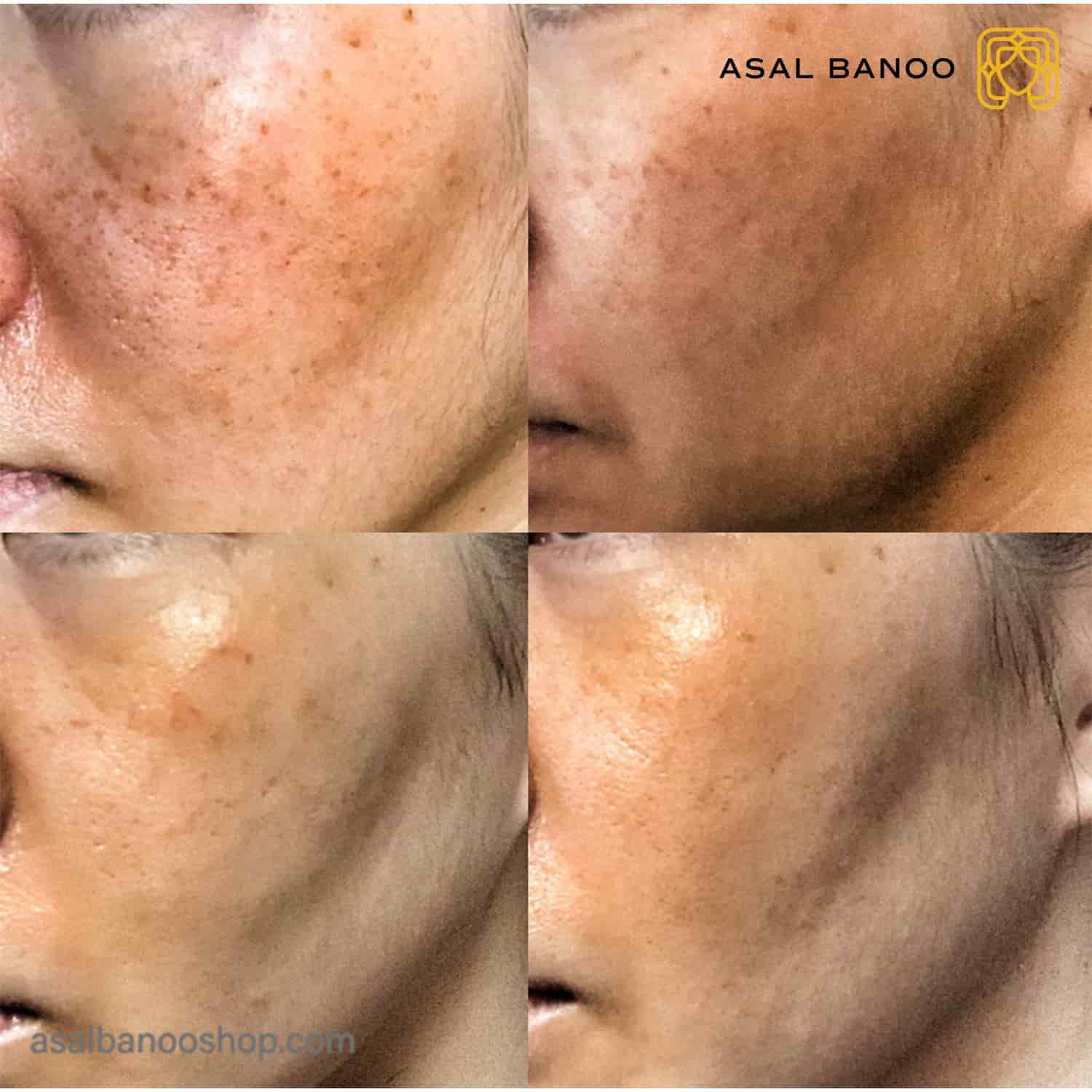 سرم آنتی اکسیدان PHLORETIN CF اسکین سوتیکال