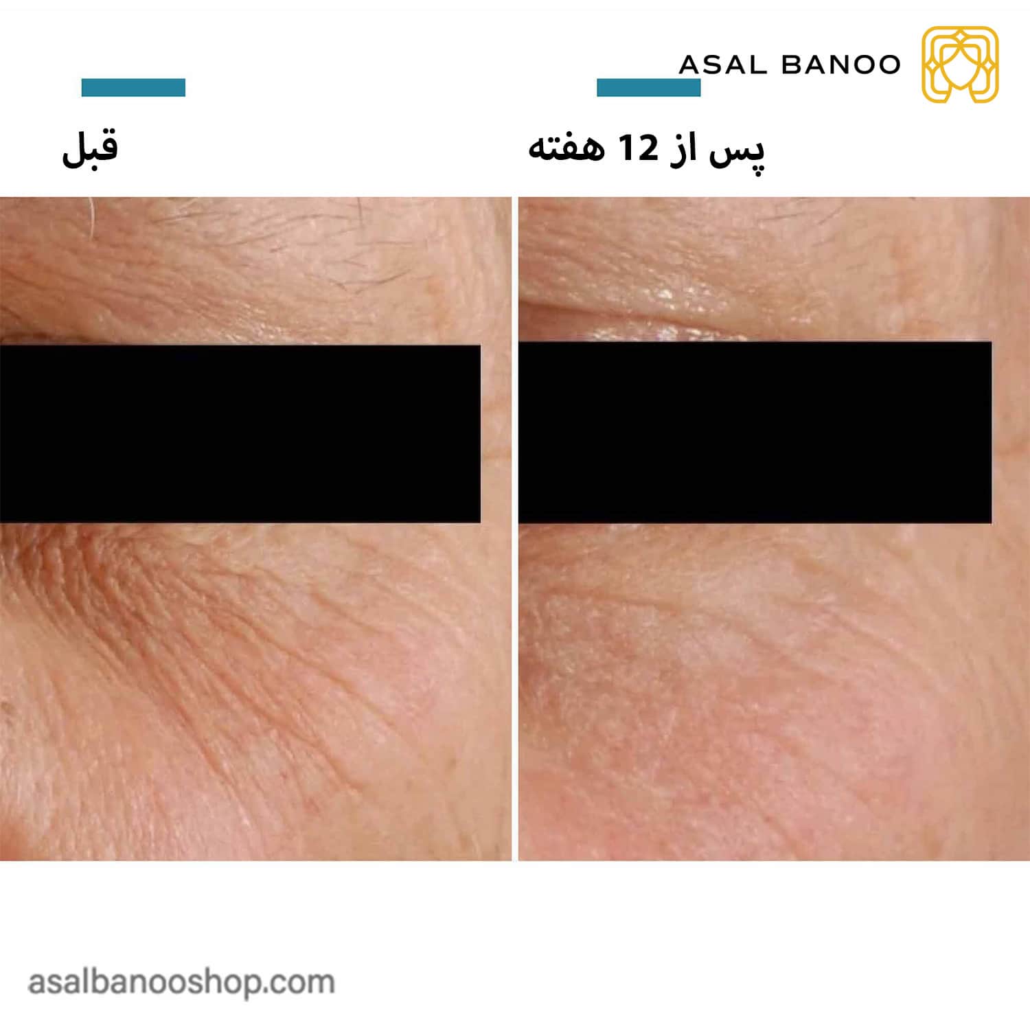 کرم دور چشم ضد پیری اسکین سوتیکال