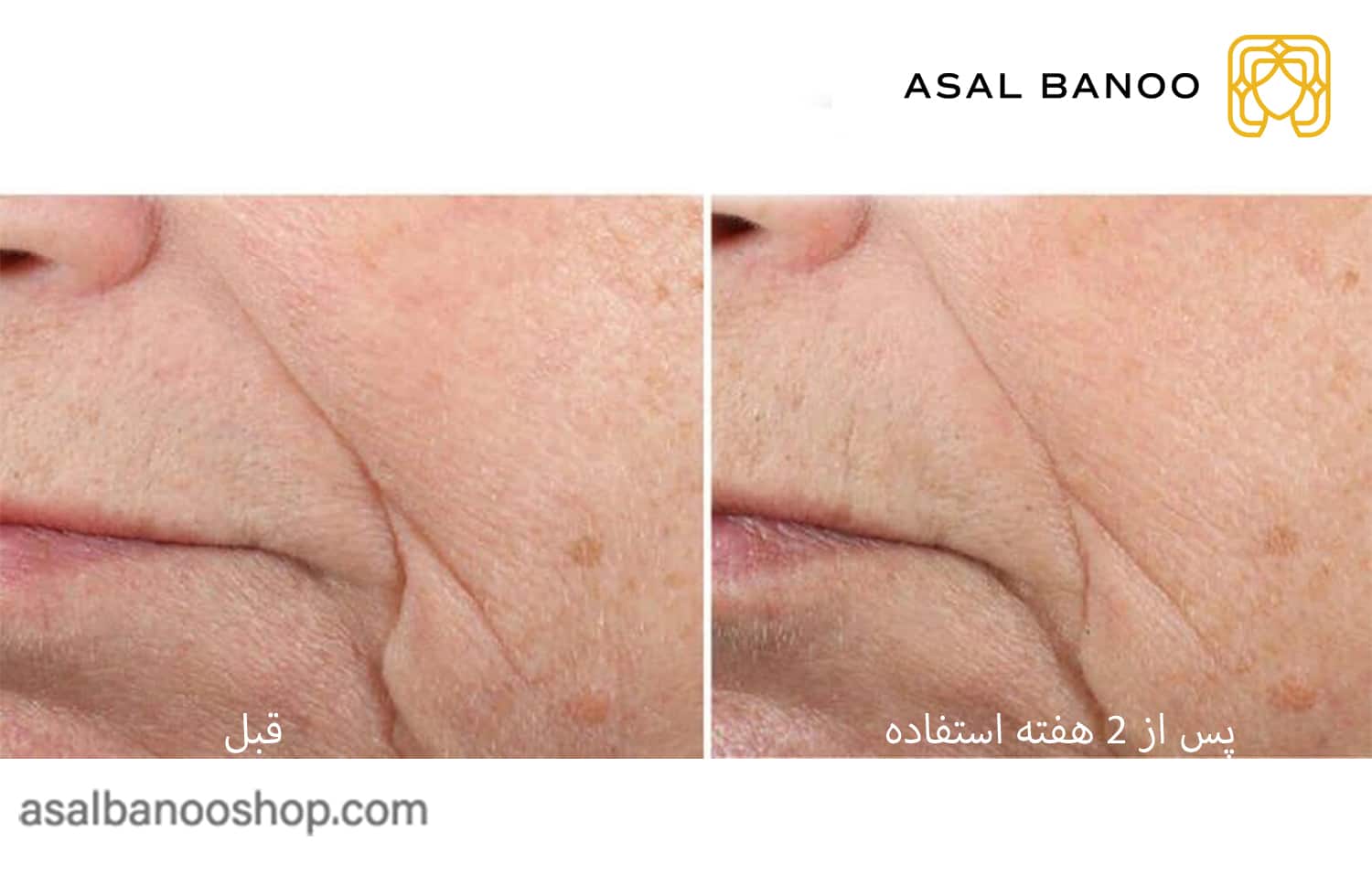Skinceuticals-triple-lipid-Restore-2_4_2-min کرم ضدچروک Triple Lipid Restore اسکین سوتیکال