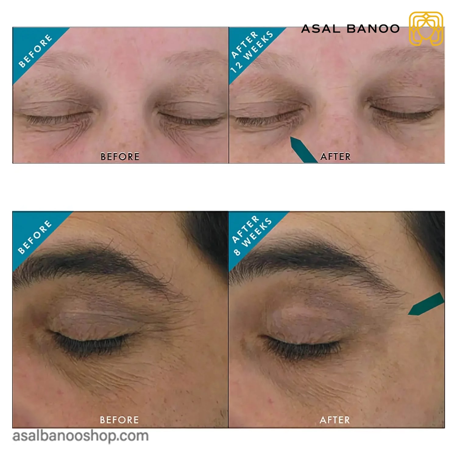 ژل دور چشم آنتی اکسیدان و ضد پیری اسکین سوتیکال aox-min ژل دور چشم آنتی اکسیدان و ضد پیری اسکین سوتیکال AOX
