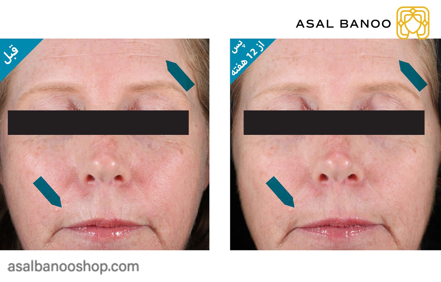 کنسانتره شب آنتی اکسیدان Resveratrol B E اسکین سوتیکال