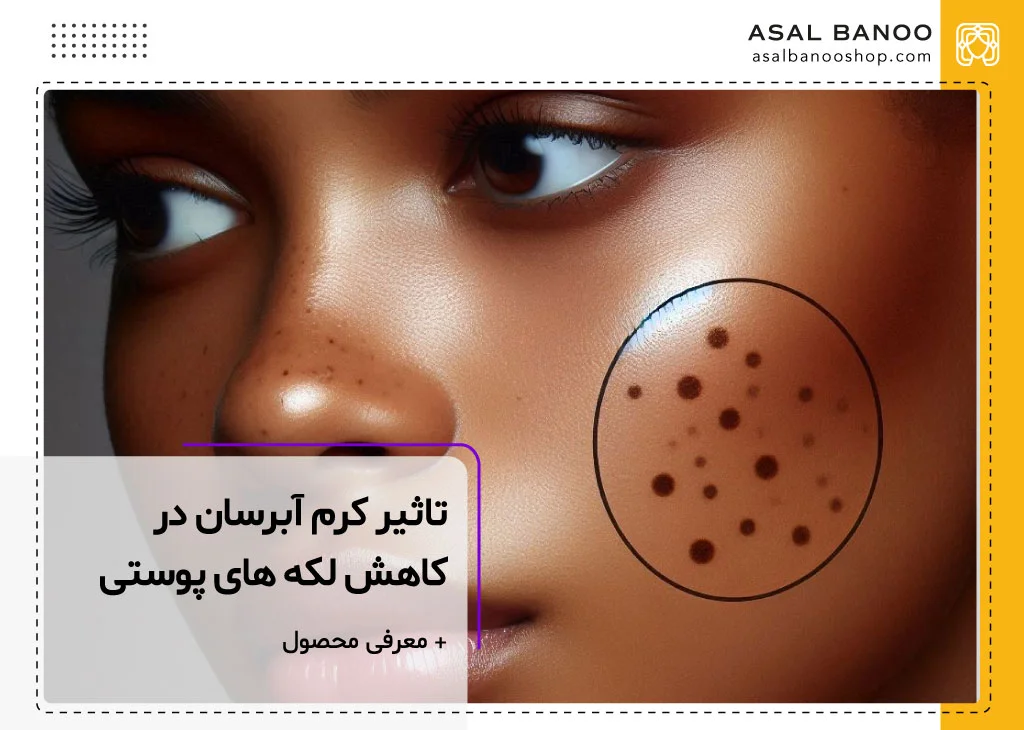 کرم آبرسان برای لک صورت خوبه؟