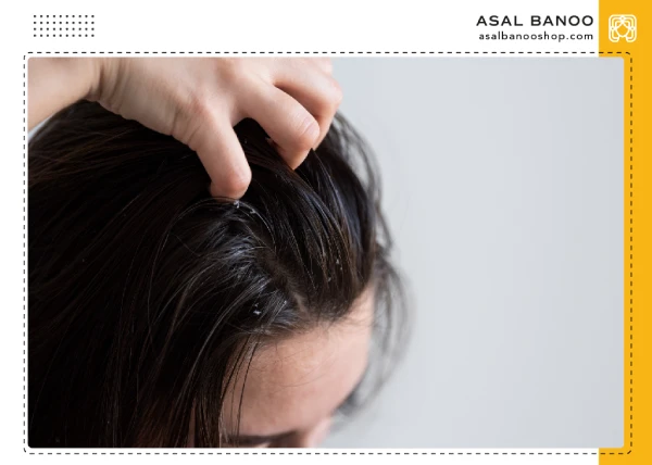 Oily-hair موی چرب