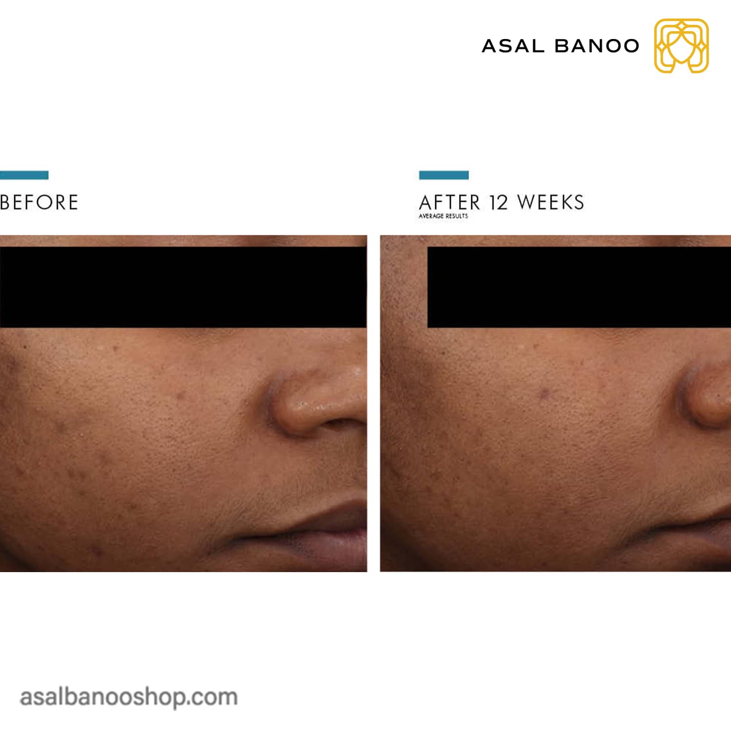 SkinCeuticals-Advanced-Brightening-UVDefense-Sunscreen-beforeafter-min ضدآفتاب روشن کننده اسکین سوتیکال
