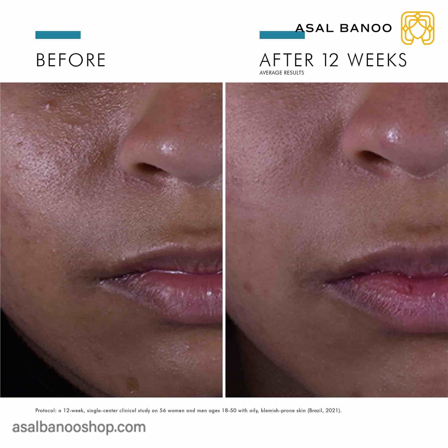 SkinCeuticals-SilymarinCF2-min سرم ویتامین سی Silymarin CF اسکین سوتیکال