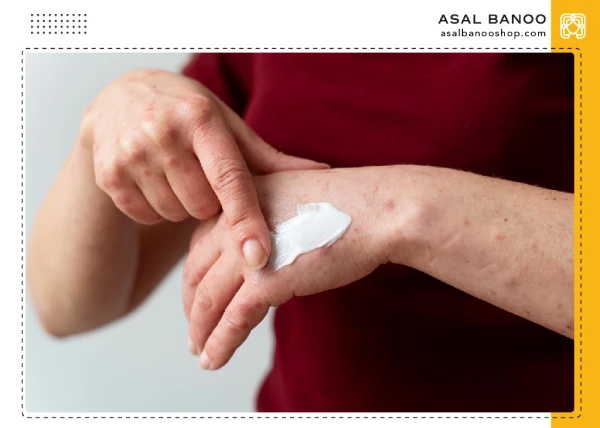 the-best-healing-cream-wounds-and-burns ترمیم کننده برای زخم