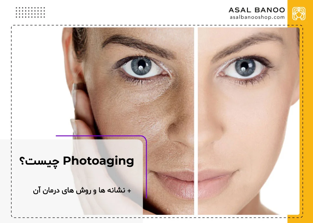 photoaging چیست