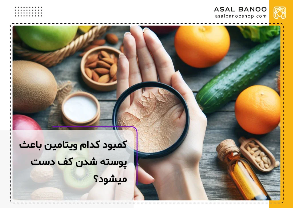 کمبود کدام ویتامین باعث پوسته شدن کف دست میشود؟