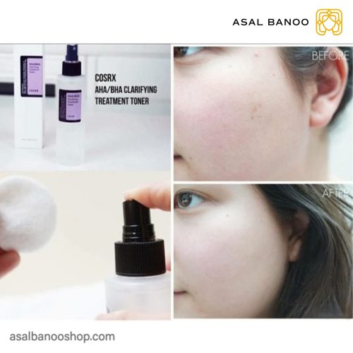 تونر لایه بردار کوزارکس