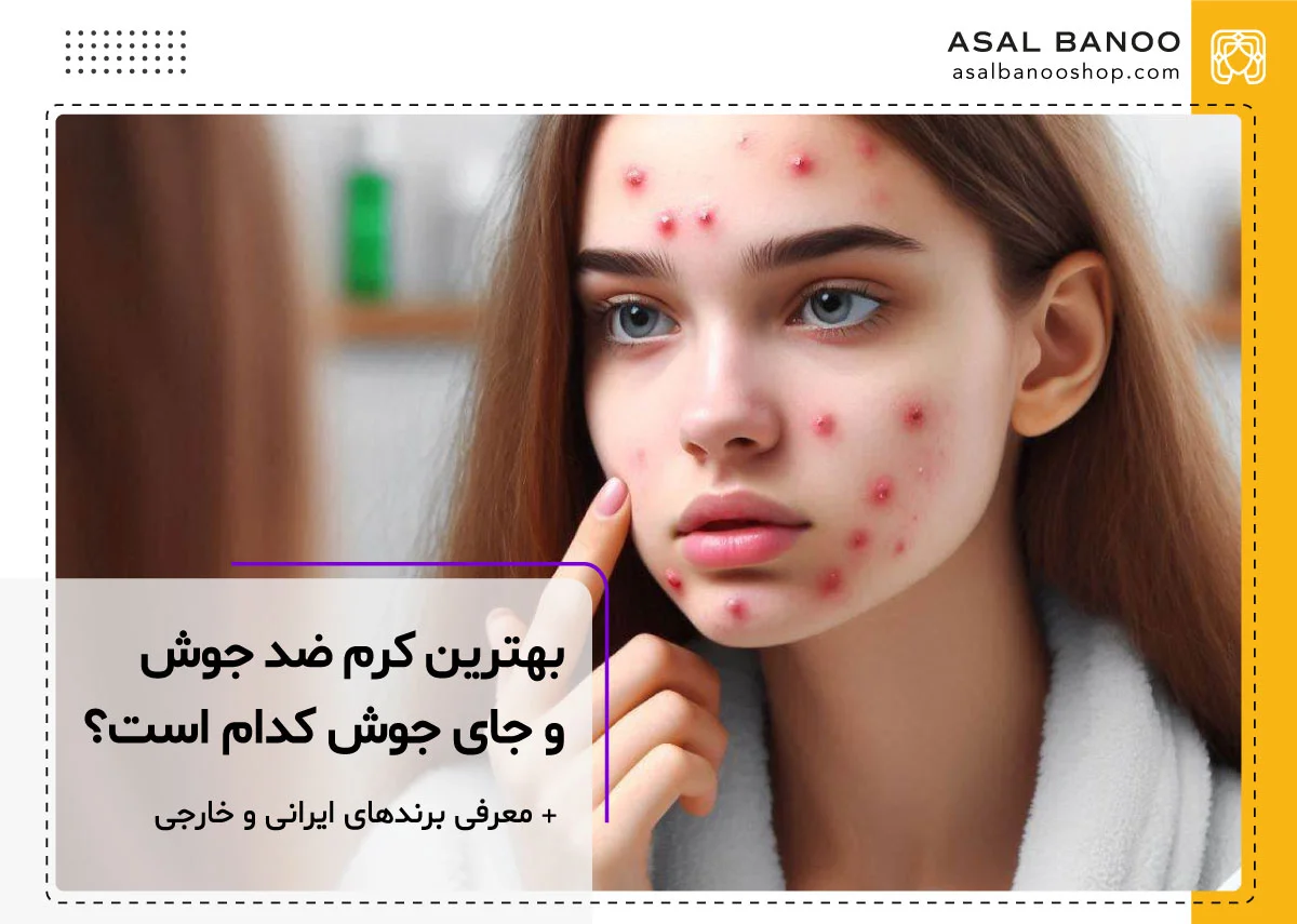 بهترین کرم ضد جوش و جای جوش