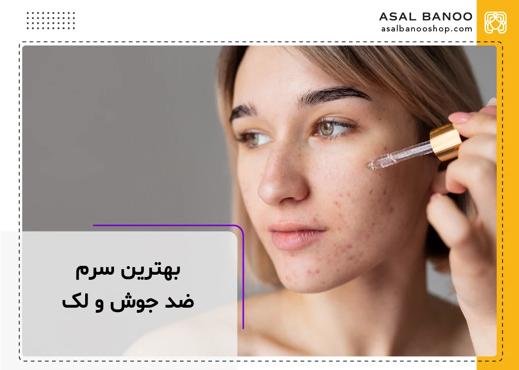 بهترین سرم ضد جوش و لک