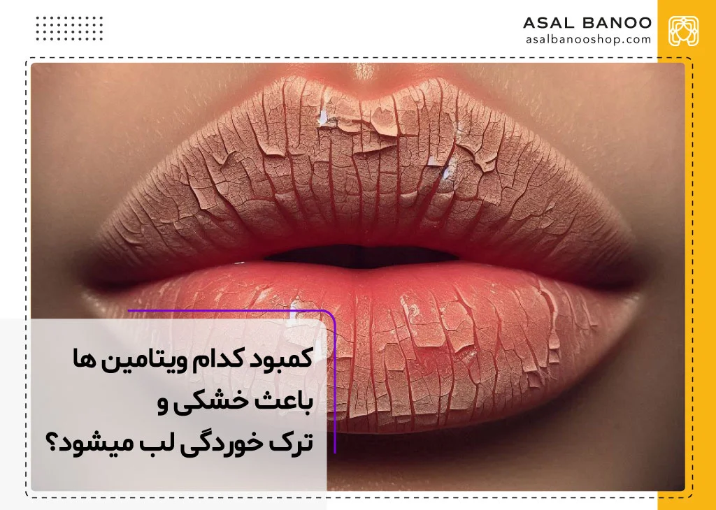 خشکی لب در اثر کمبود کدام ویتامین است؟