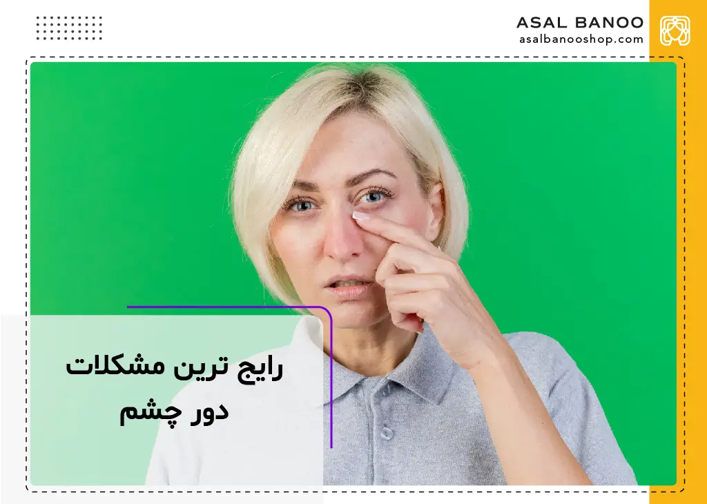 رایج ترین مشکلات دور چشم