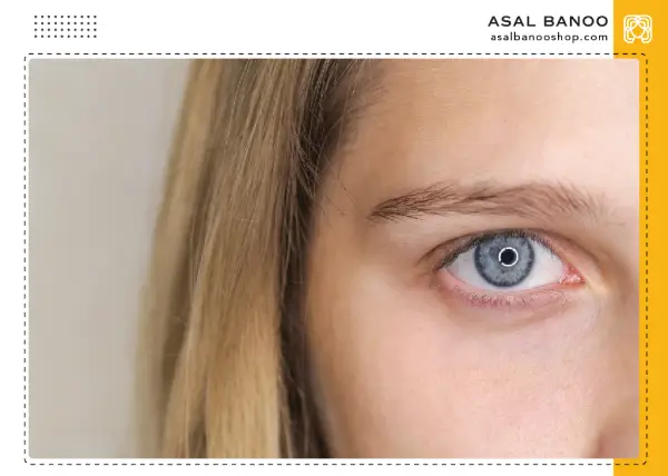 the-most-common-problems-around-eyes رایج ترین مشکلات اطراف چشم