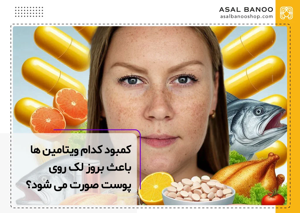کمبود کدام ویتامین باعث لک صورت می شود؟