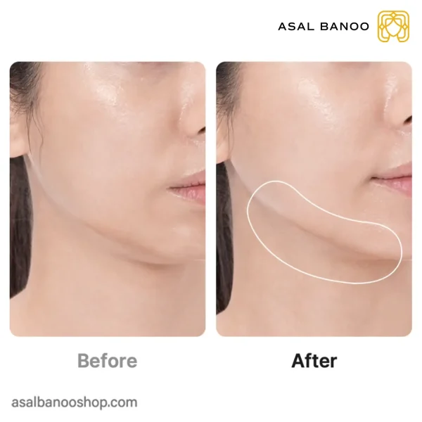 دستگاه جوانساز پرو بوستر مدی کیوب AGE-R Booster Pro